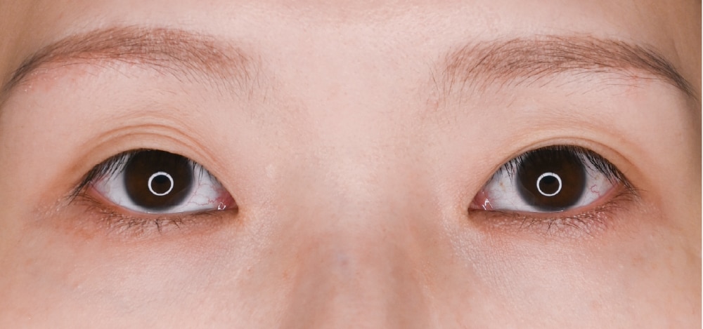 👀 ③ 食い込みが弱くなっている