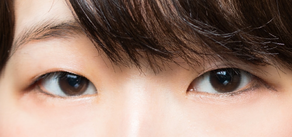 👀 ① まぶたの厚み・脂肪が多い