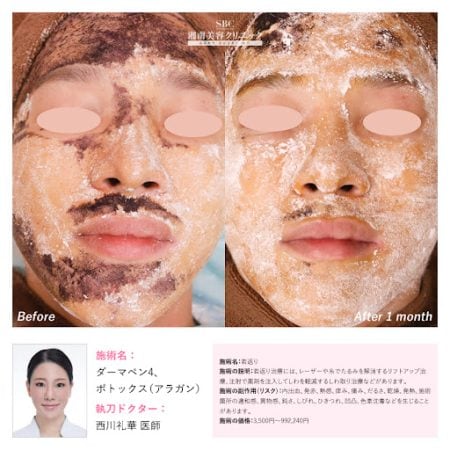顔全体の汗や皮脂を抑制