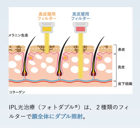 フォトダブル