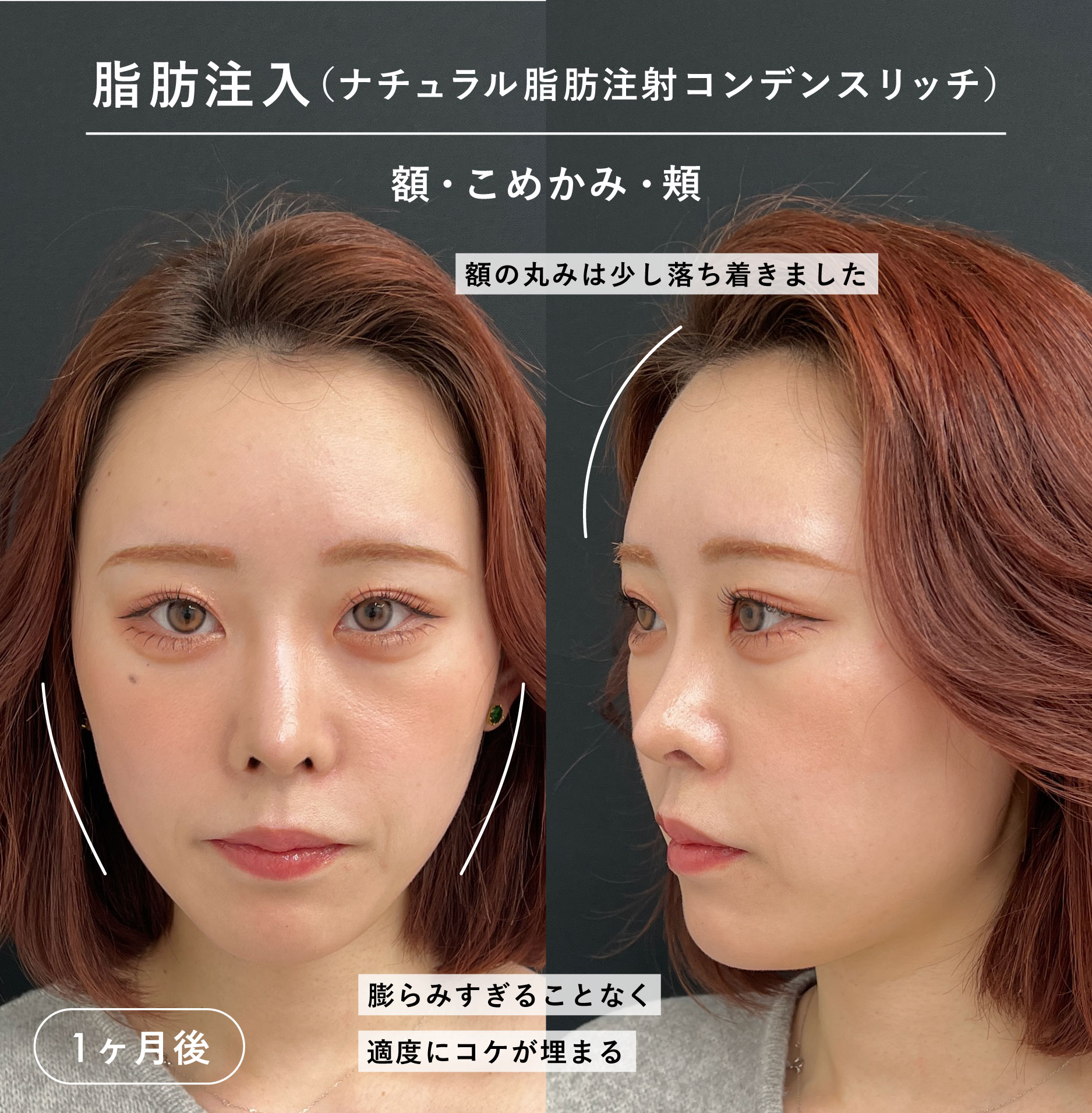 1ヶ月後