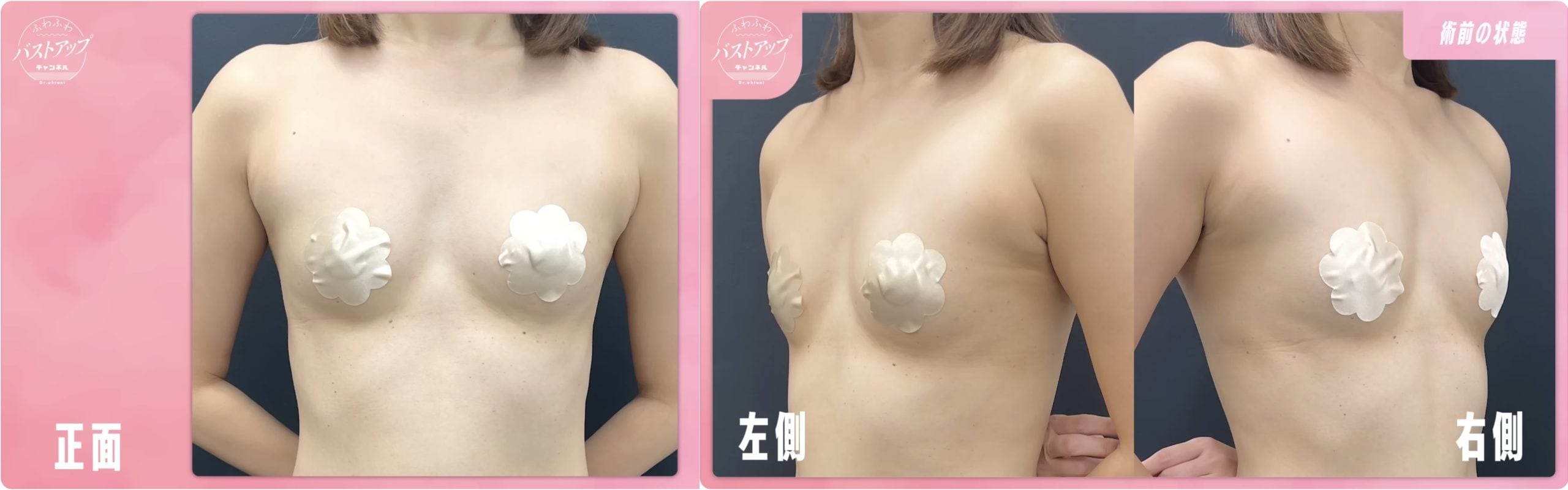 手術前の状態