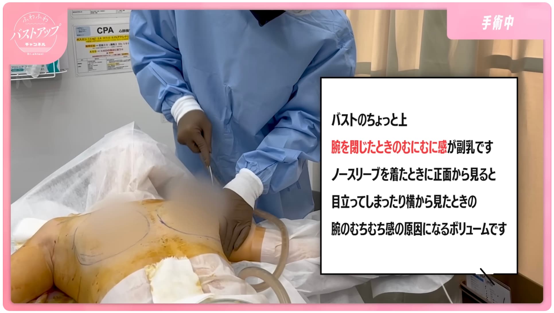 副乳除去でよりキレイなバストへ✨