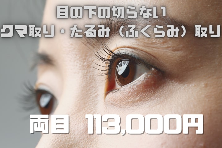 目の下の切らないクマ取り・たるみ(ふくらみ)取り:113,000円