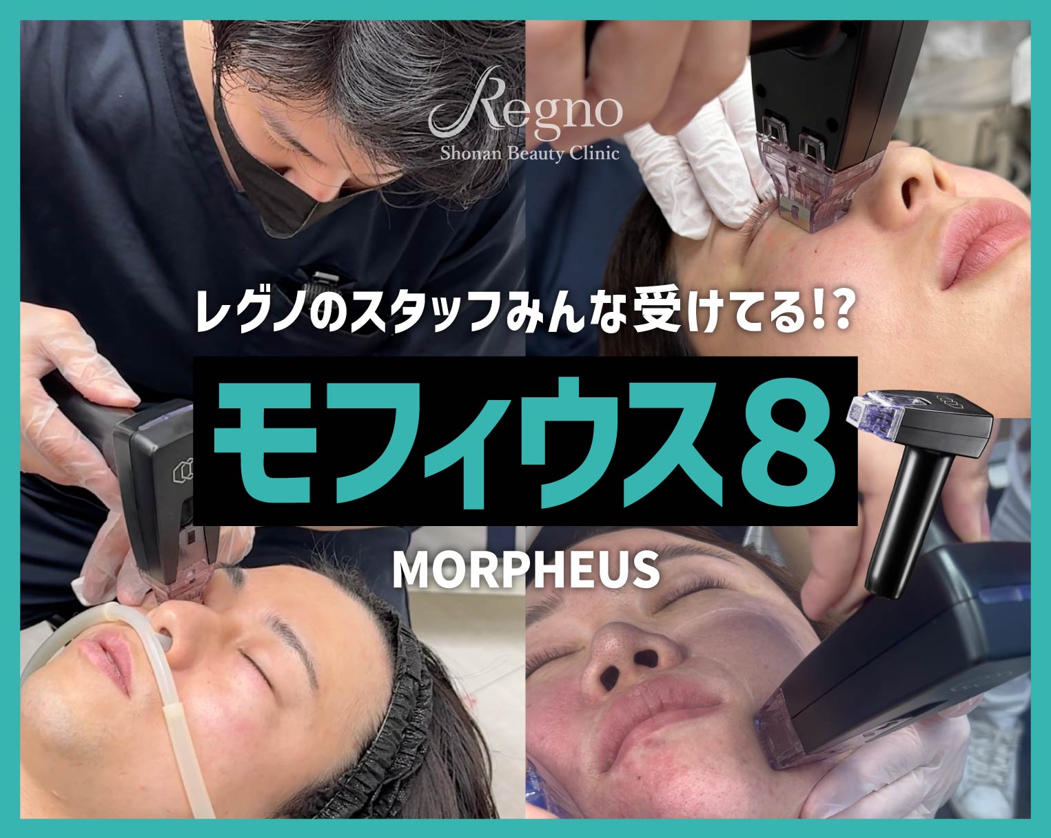 【最新マイクロニードルRF】Regno銀座院スタッフはみんなやってる！？モフィウス8で強力タイトニング！