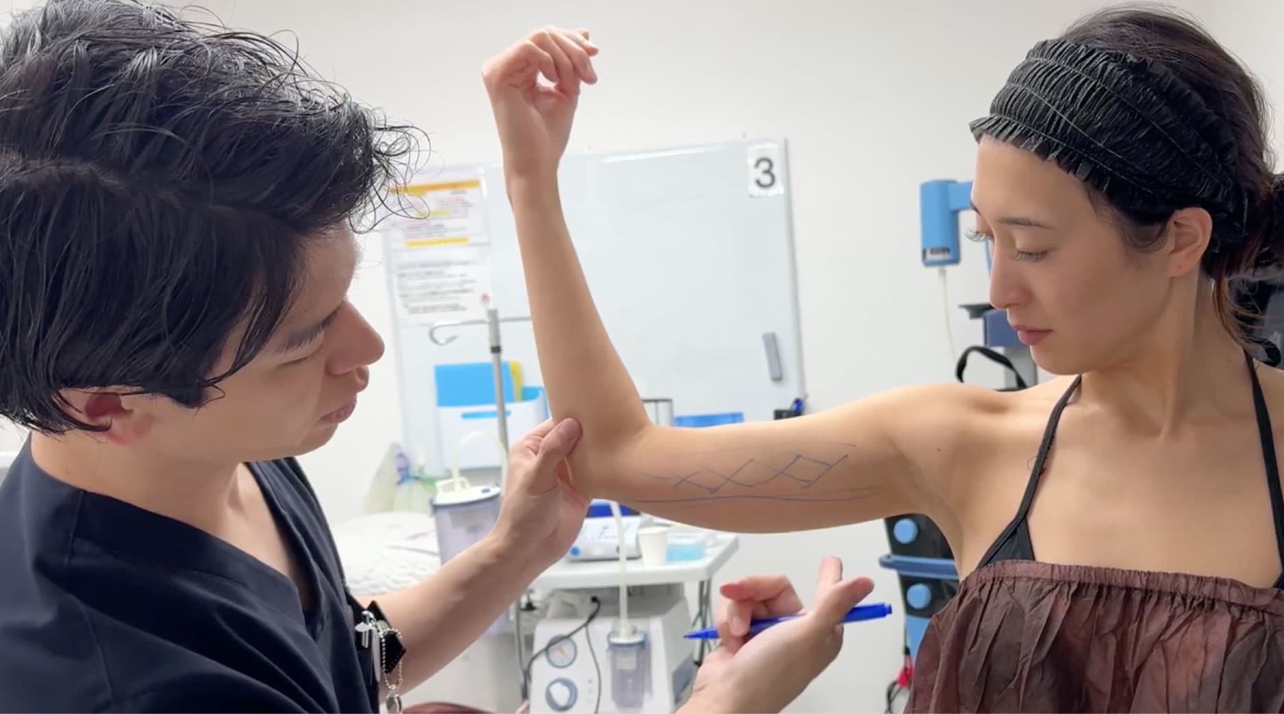 二の腕の脂肪吸引の場合