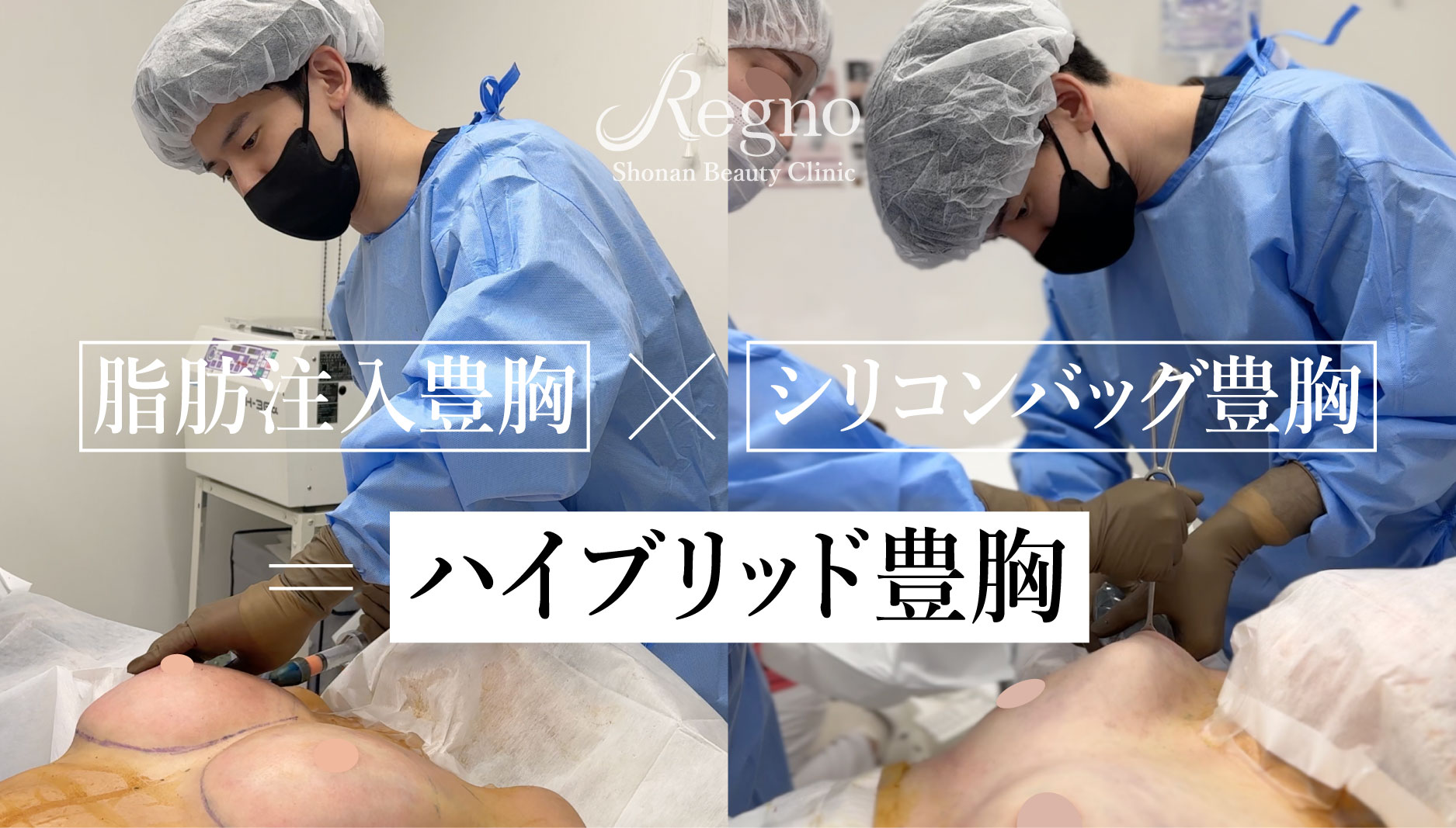 脂肪注入豊胸✖️シリコンバッグ豊胸＝ハイブリッド豊胸