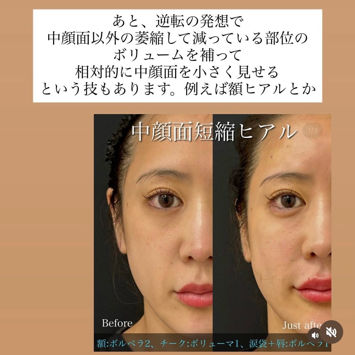 応用編