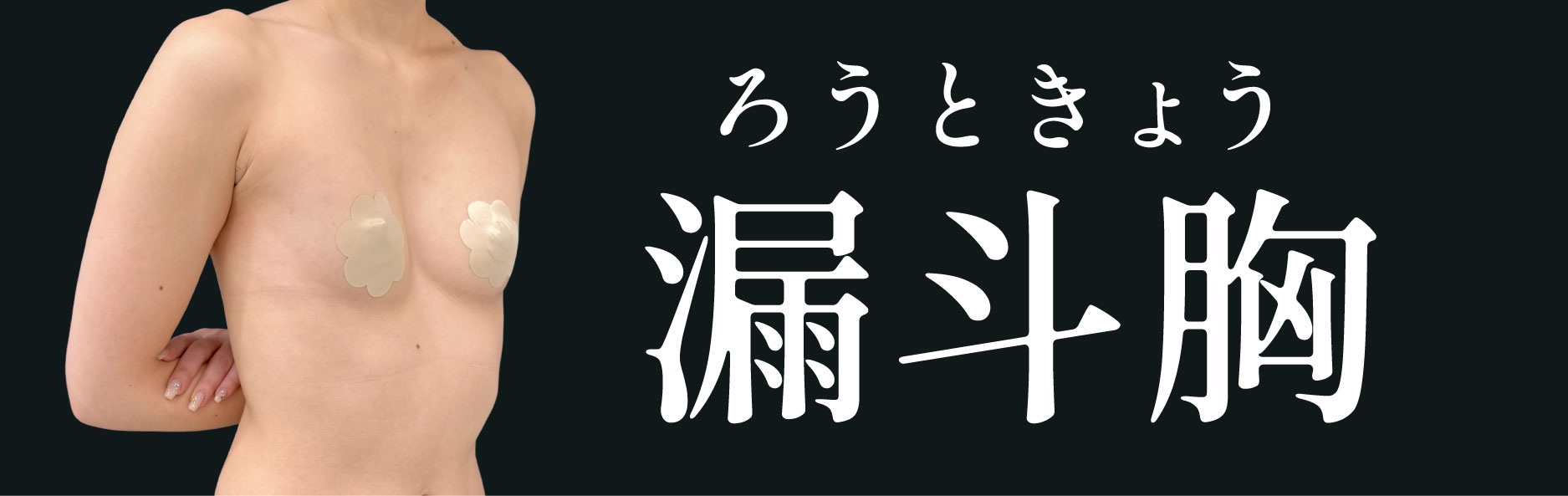 漏斗胸(ろうときょう)とは