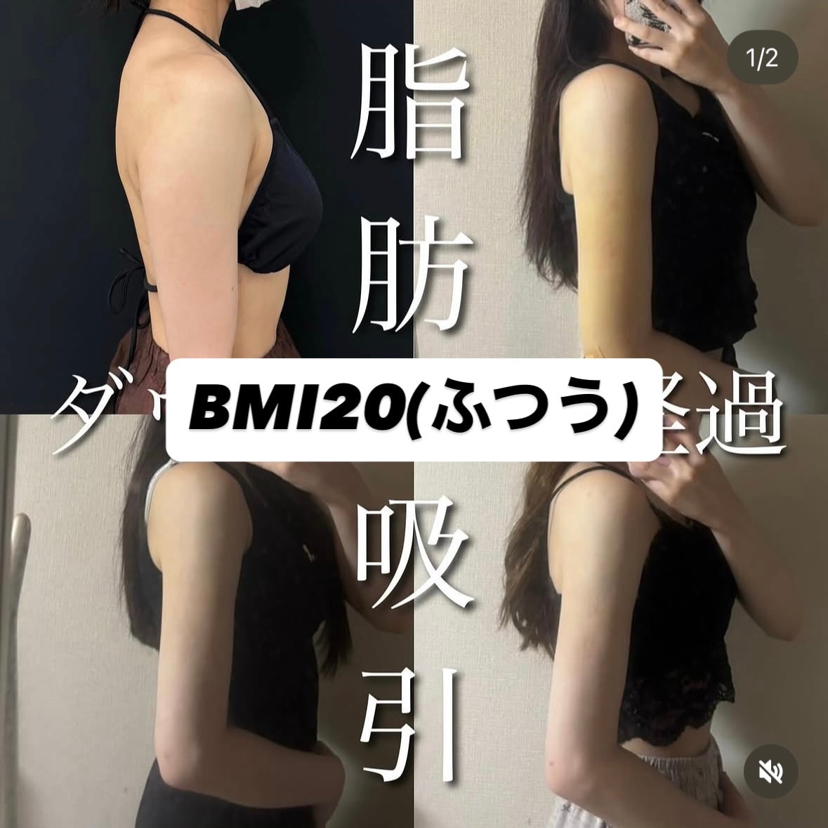 「体重を落としても二の腕だけ残る」体型