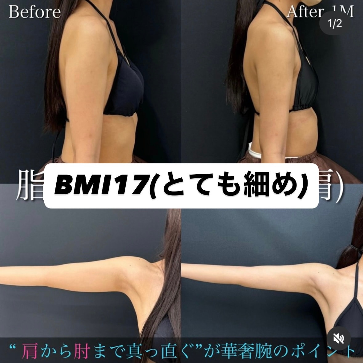 「これより細いと適応がないとされる可能性がある」体型