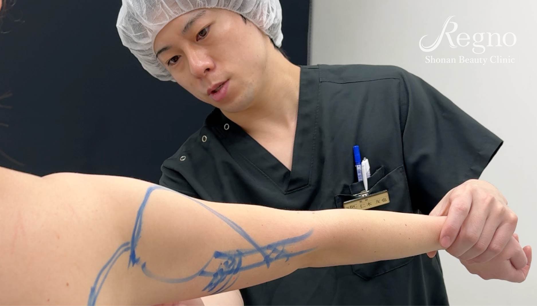 二の腕脂肪吸引をしたいけど、自分と同じ体型の症例が見たい！という方へ