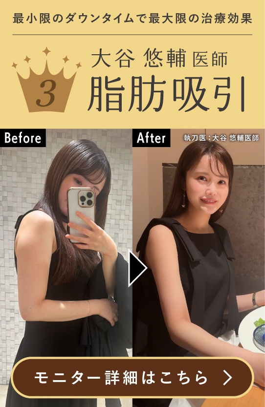【脂肪吸引】女性らしいボディラインになれると人気！大谷先生の脂肪吸引