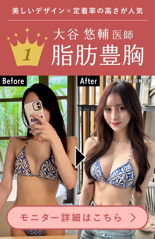 【脂肪豊胸】大谷院長イチオシ！バストアップと部分痩せが一度に叶う嬉しい施術☆