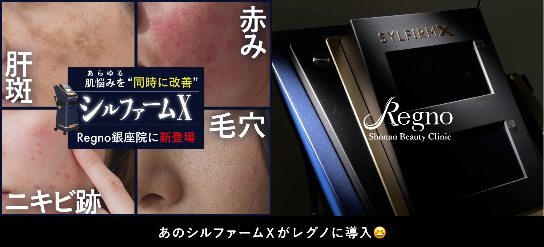 【新導入】シルファームX