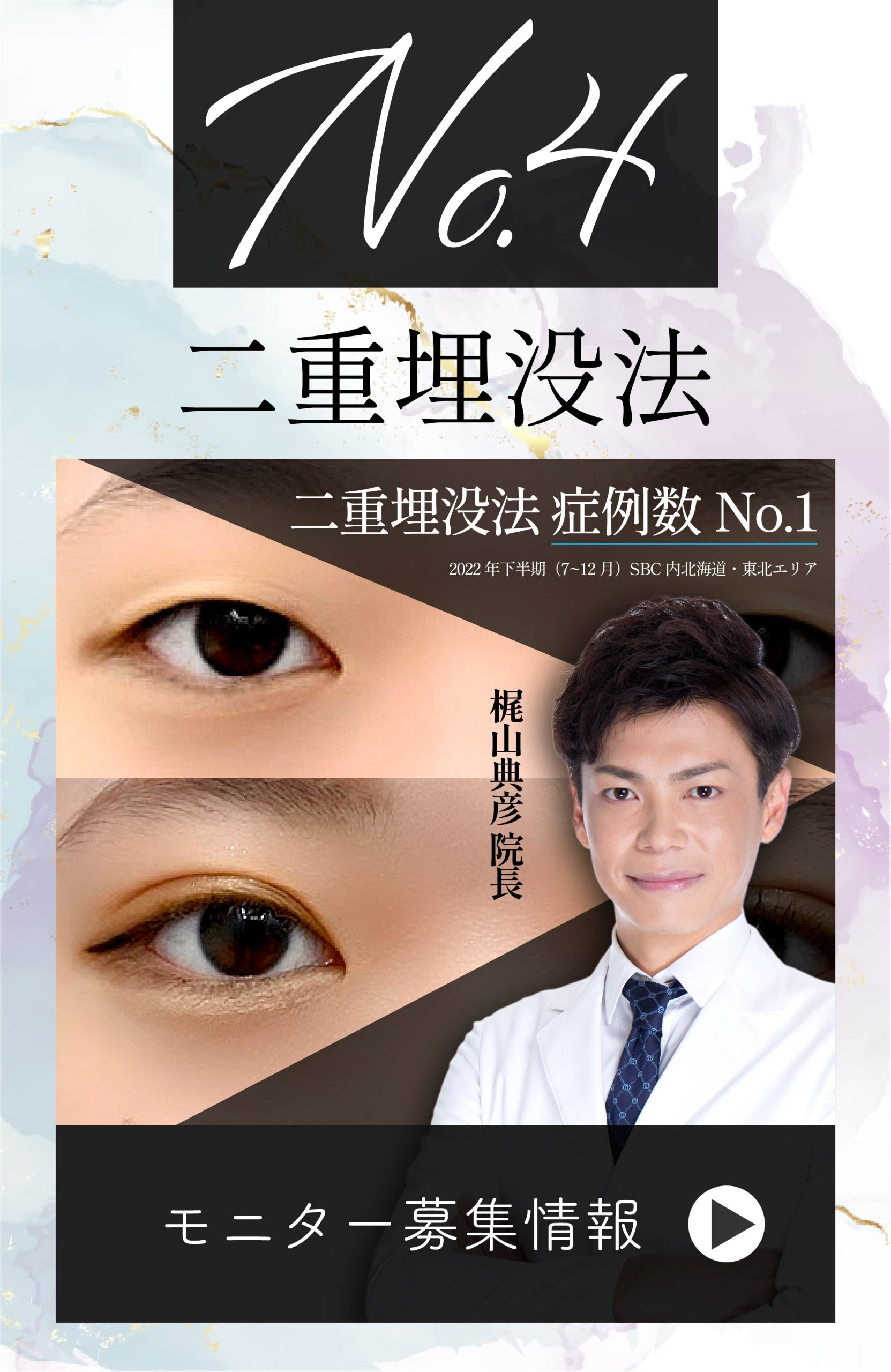 【二重埋没法👑症例数No.1】SNSからも指名殺到！💌名医・梶山院長が手掛けるオーダーメイド二重術👀💕【モニター募集中📮】