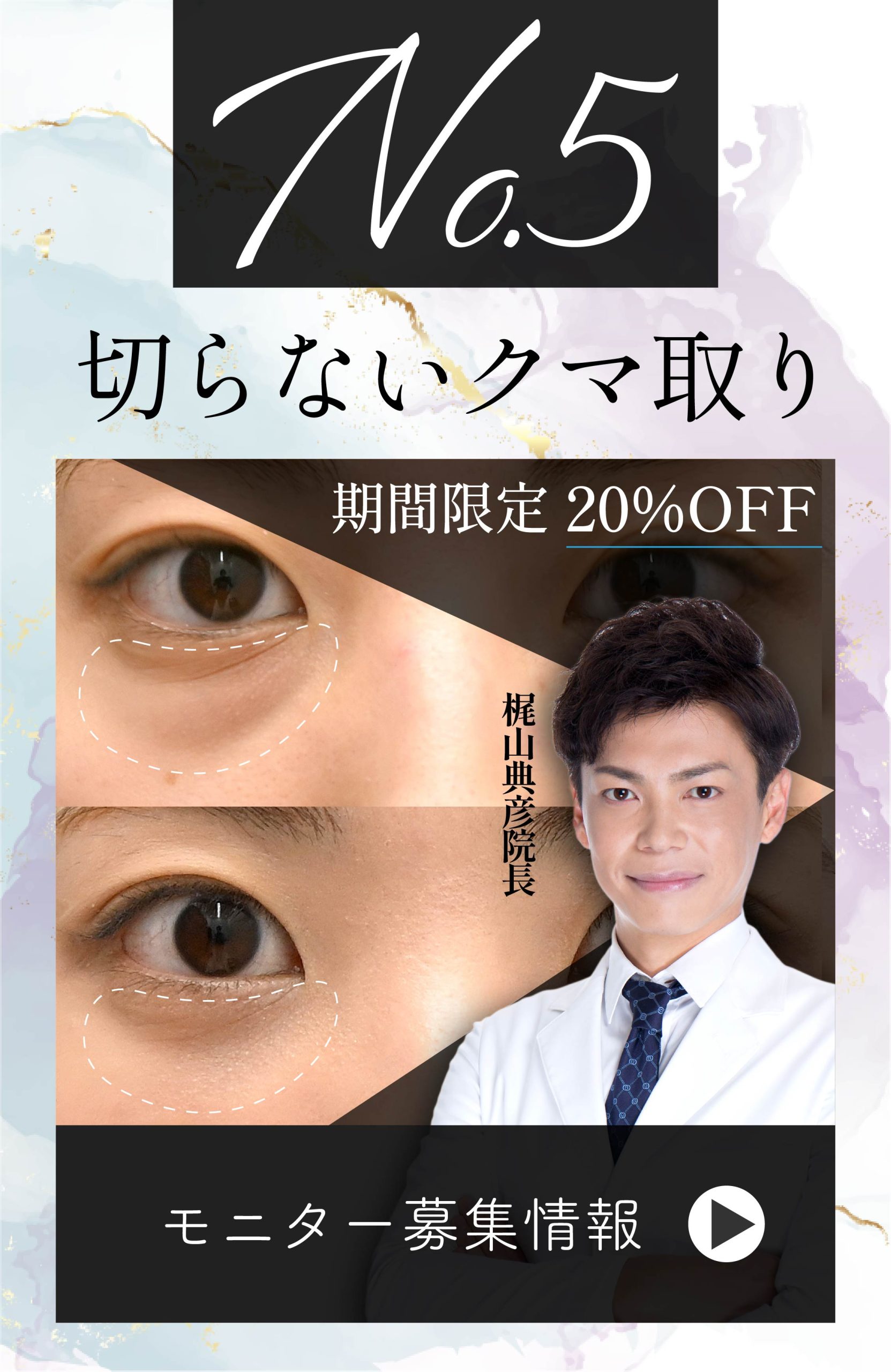 【クマ取り💝症例数No.1】期間限定20%OFF！🎉梶山院長が手掛ける目の下の切らないクマ・たるみ取り🧸🧡【モニター募集中📮】