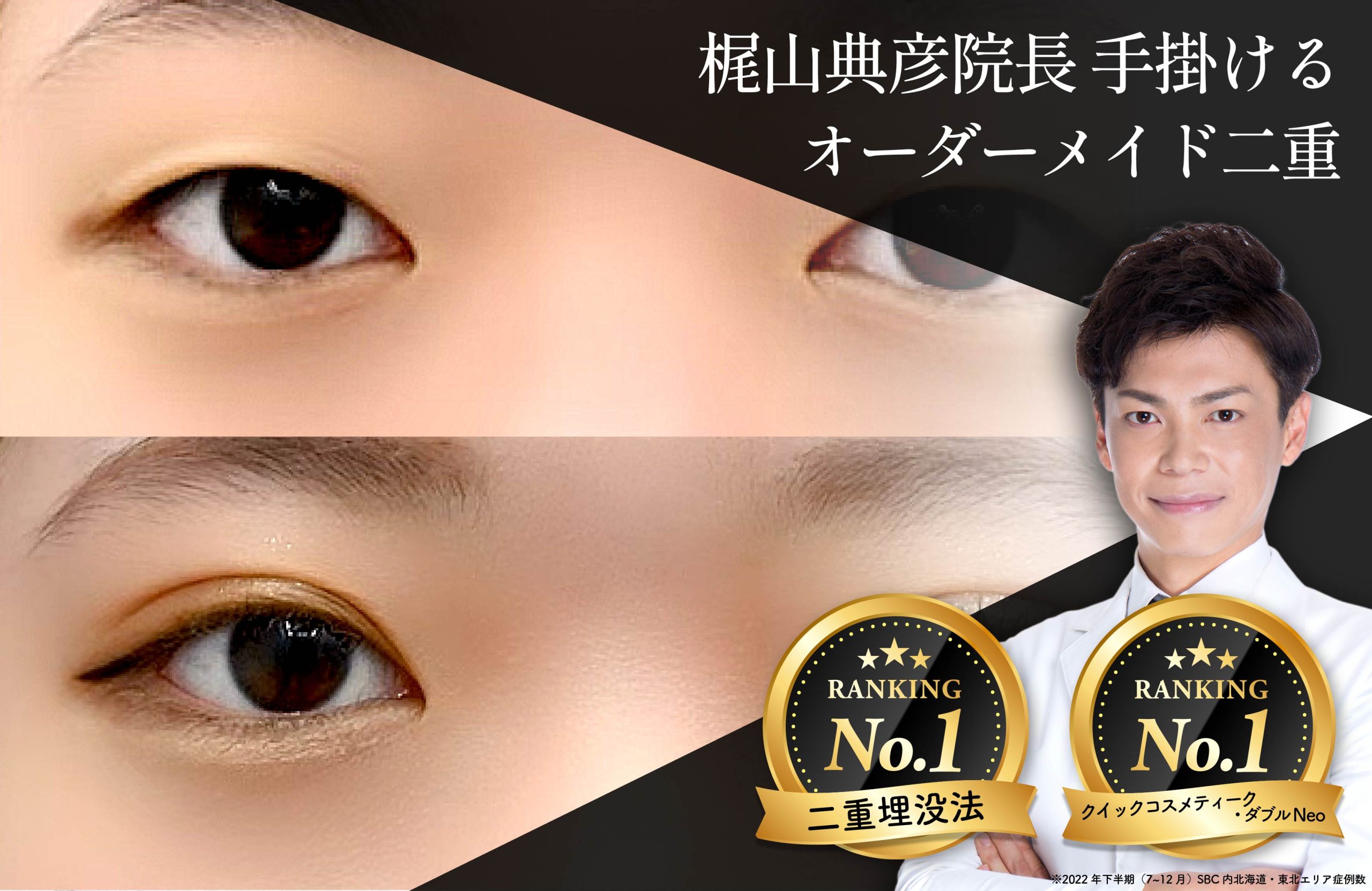 名医・梶山院長が手掛けるオーダーメイド二重術👀💕