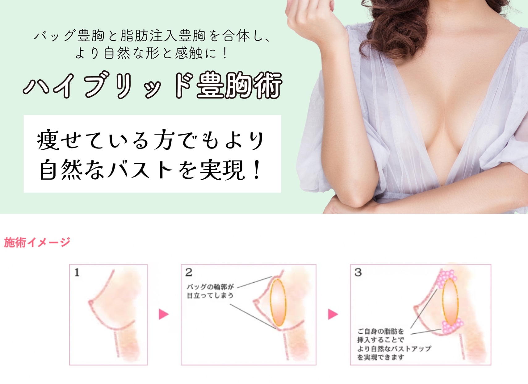ハイブリッド豊胸