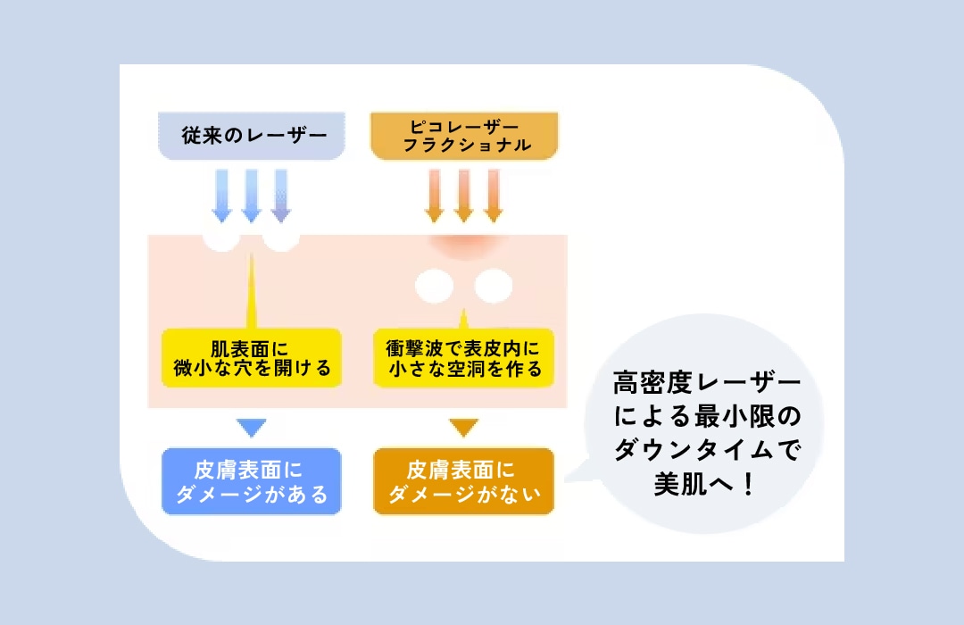 どんな施術？