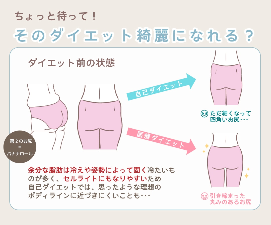 自己ダイエットの罠