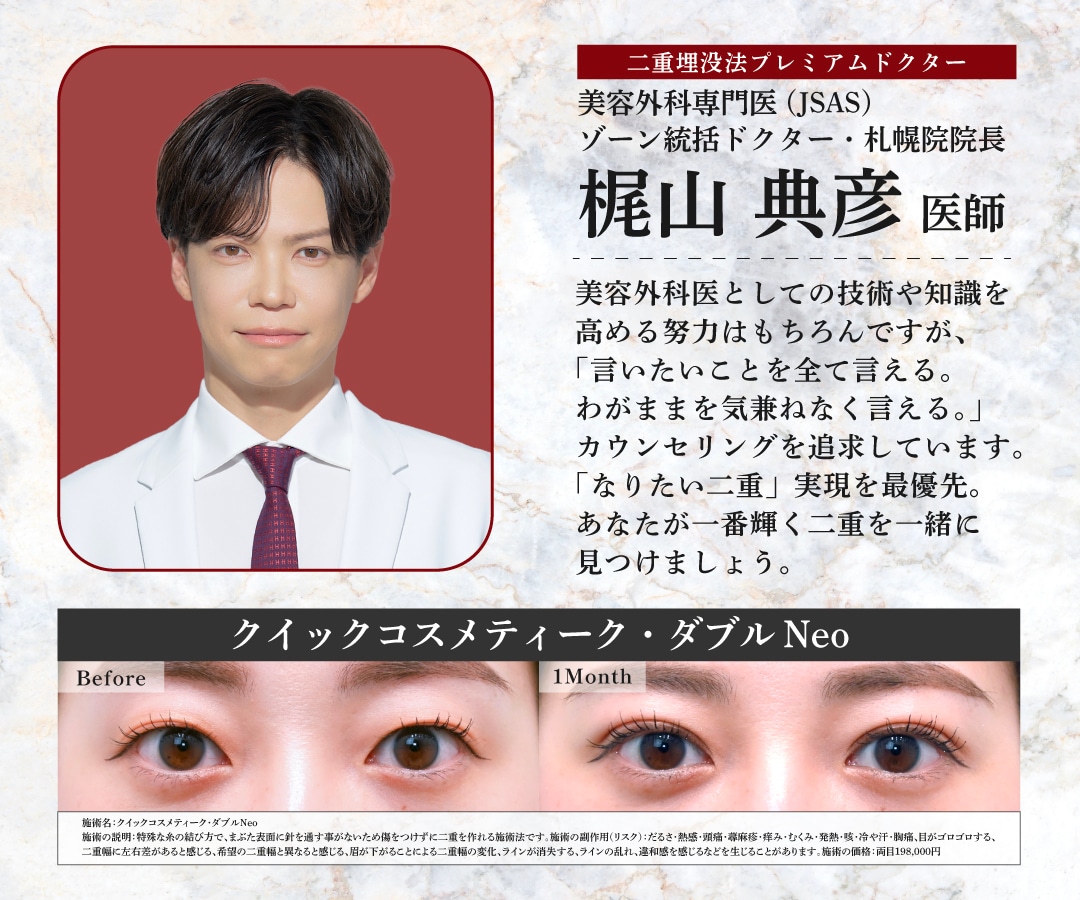 札幌で二重に挑戦するなら湘南美容クリニックへ👀✨ - 札幌院