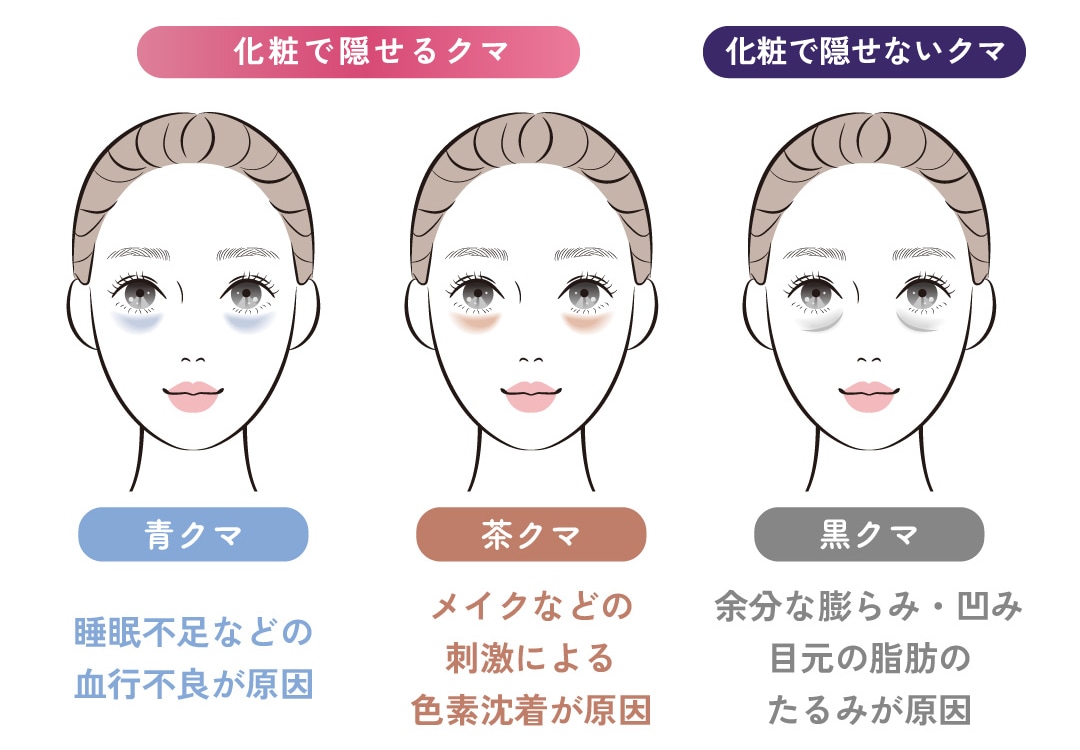 【化粧で隠せる2種類のクマ】