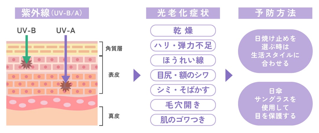 光老化の予防【紫外線】