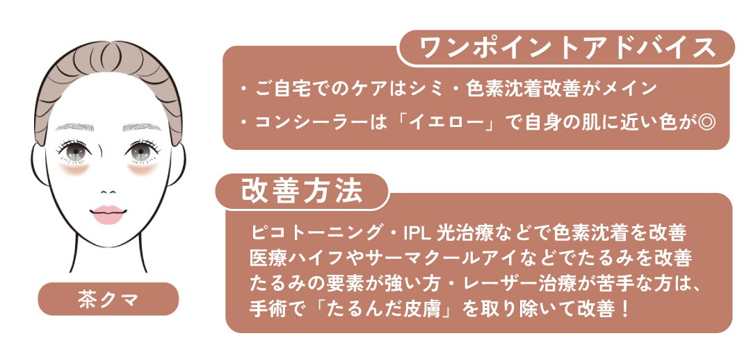 【化粧で隠せるクマ②】茶クマ