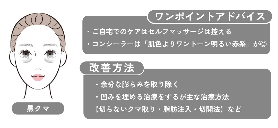 【化粧で隠せないクマ】黒クマ（影クマ）
