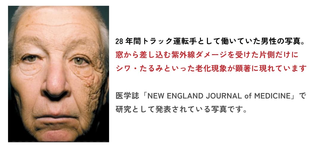 光老化の症状