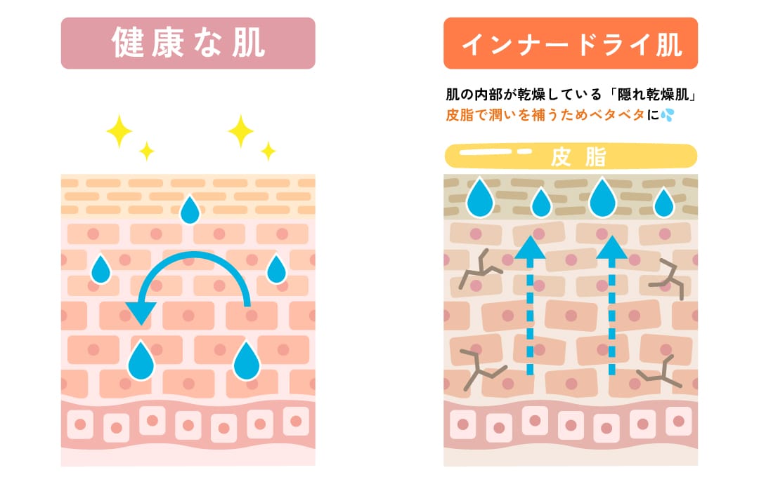 肌内部の「乾燥」が原因だった