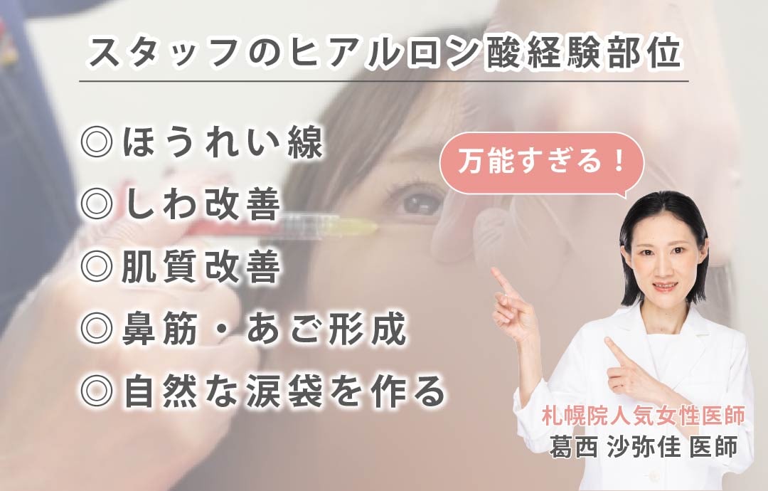 スタッフからも高い支持!