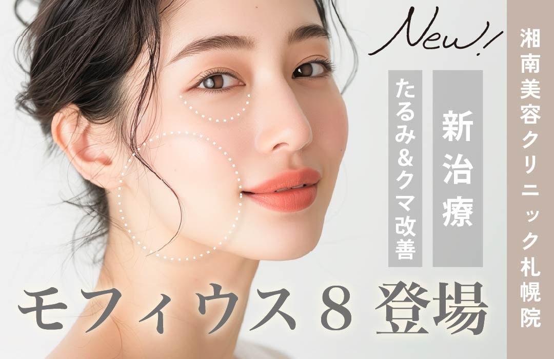 モフィウス8サムネイル
