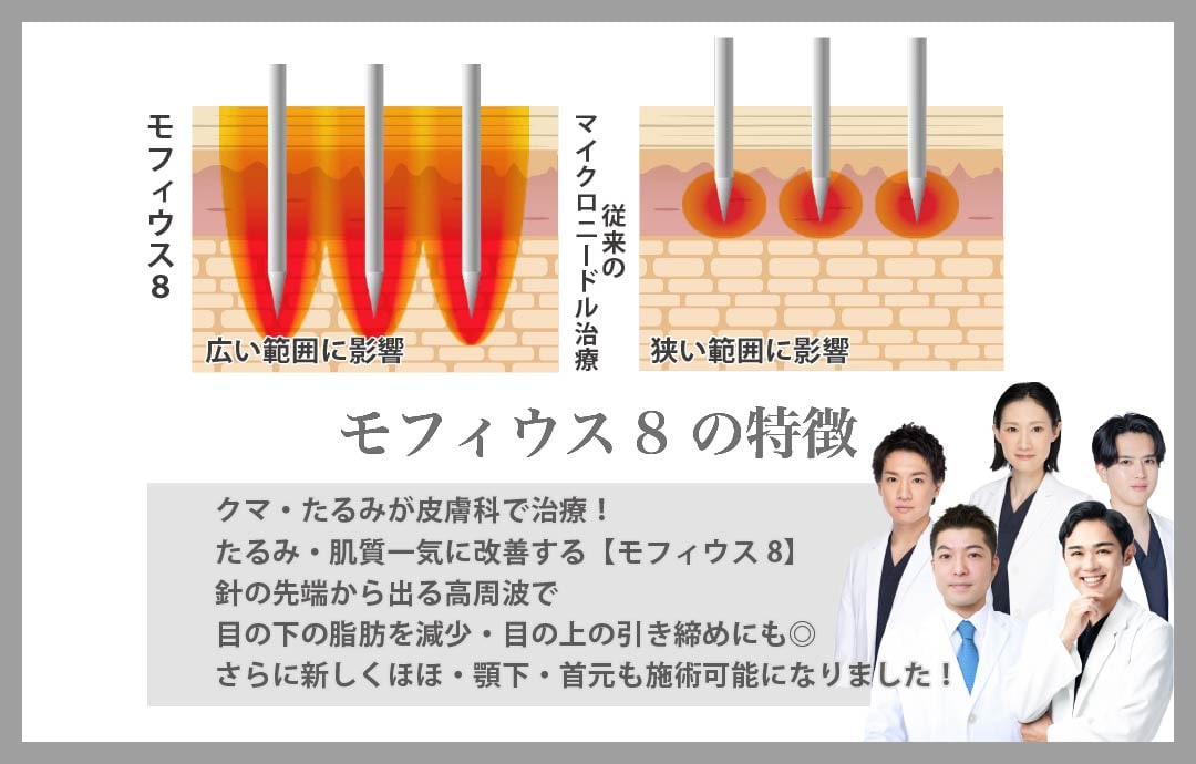 モフィウス特徴