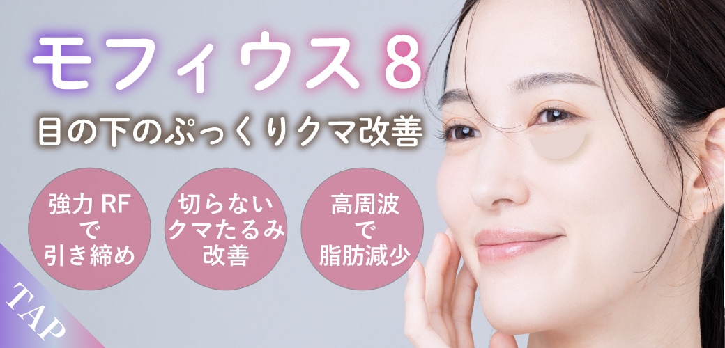 モフィウス8サムネイル