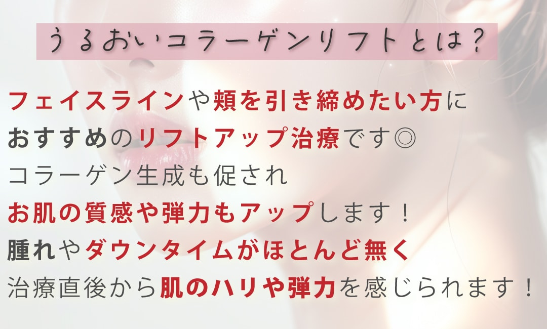 最新アンチエイジング治療『うるおいコラーゲンリフト』って？