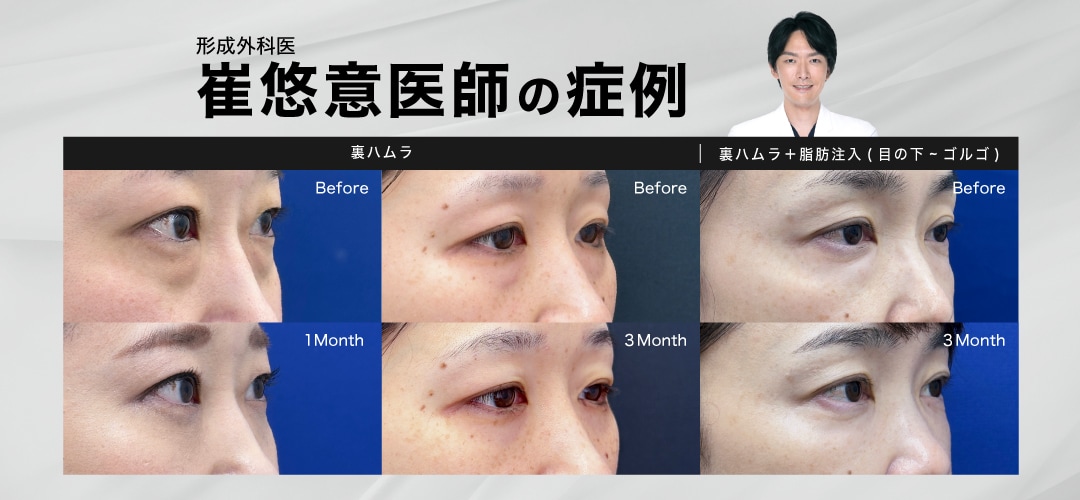 【形成外科医】 崔医師の症例