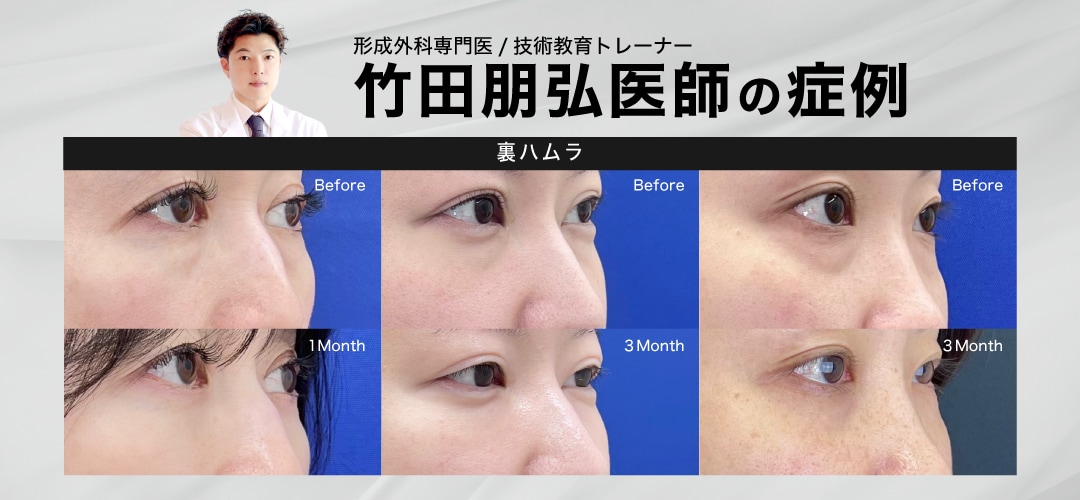 【形成外科専門医/技術教育トレーナー】 竹田医師の症例