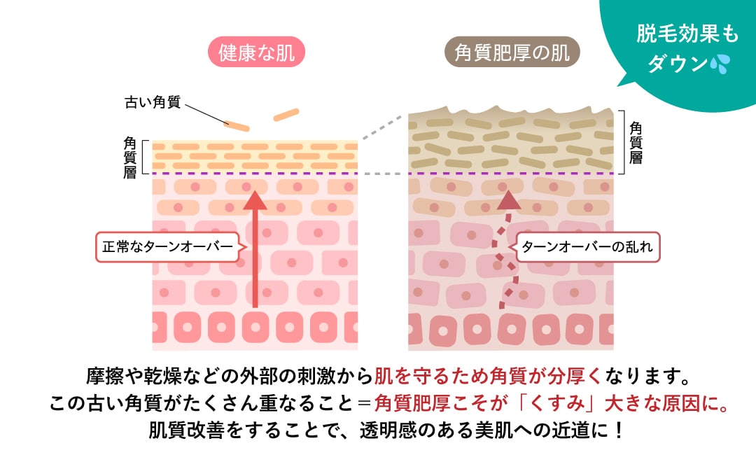 効果を最大限に実感する美肌脱毛