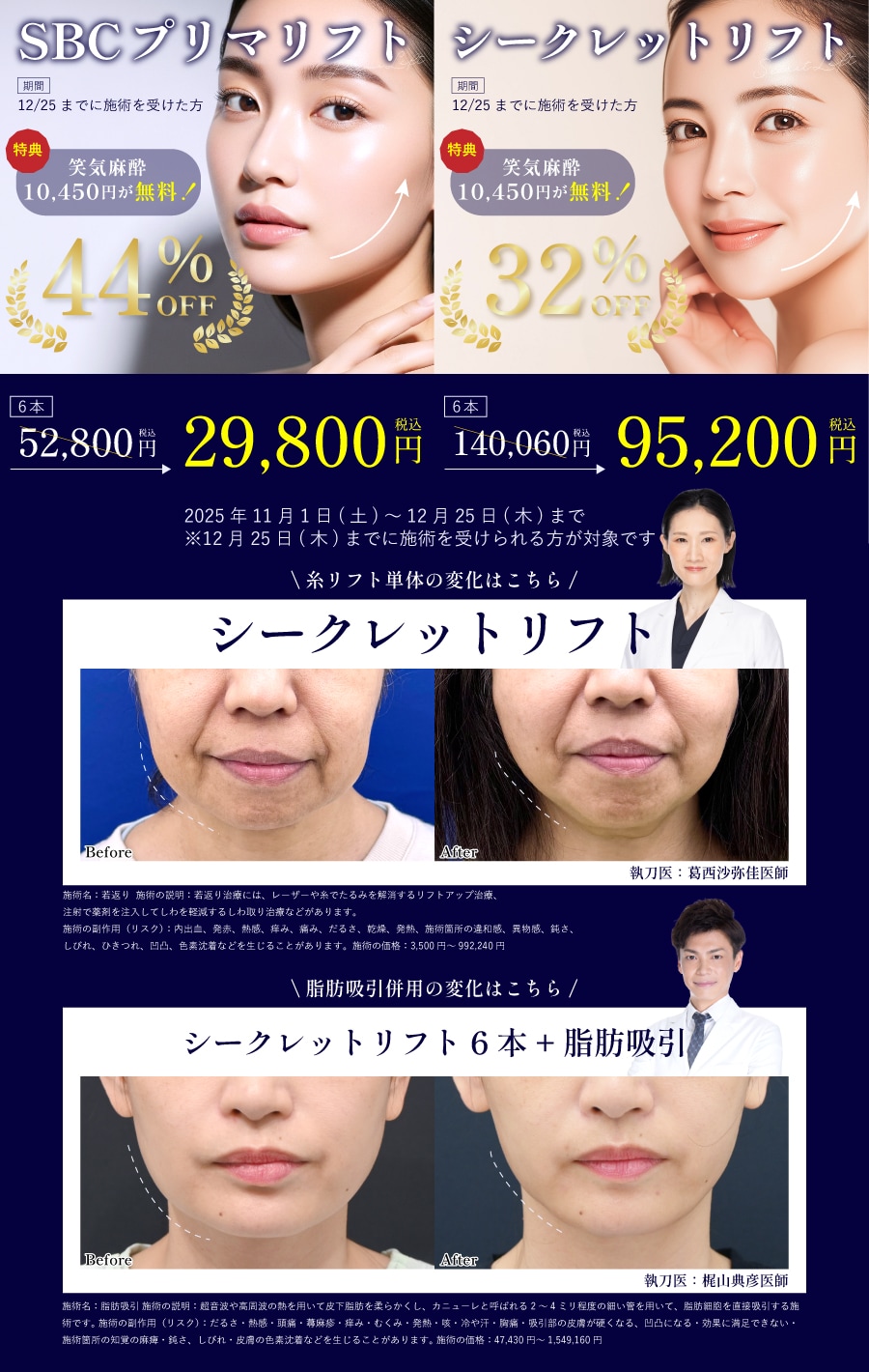 【期間限定】糸リフトがお得に！🉐