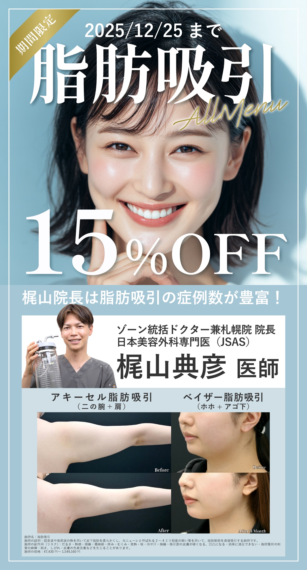＜見逃し厳禁⚠️＞脂肪吸引メニューが15％OFF！！