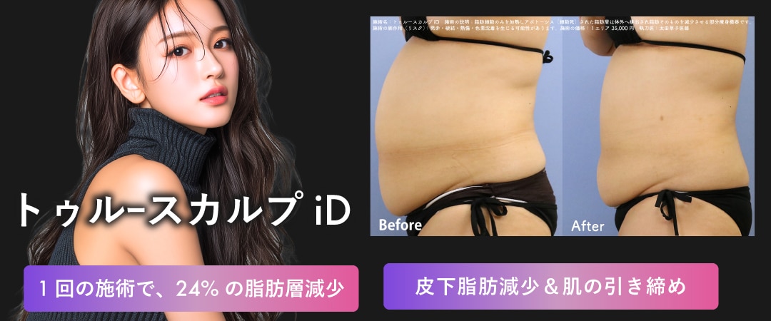 皮下脂肪撃退 ❷：トゥルースカルプ iD 