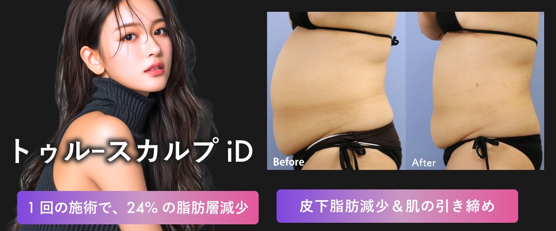 皮下脂肪撃退 ❷：トゥルースカルプ iD 