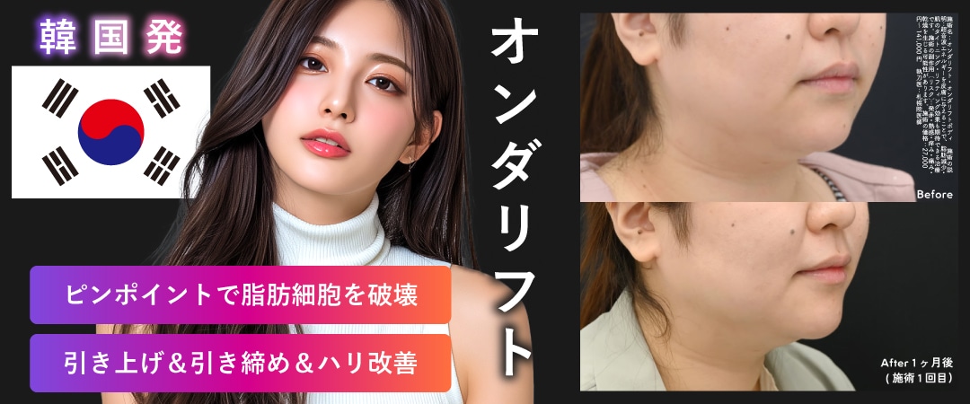 皮下脂肪撃退 ❶：オンダリフト