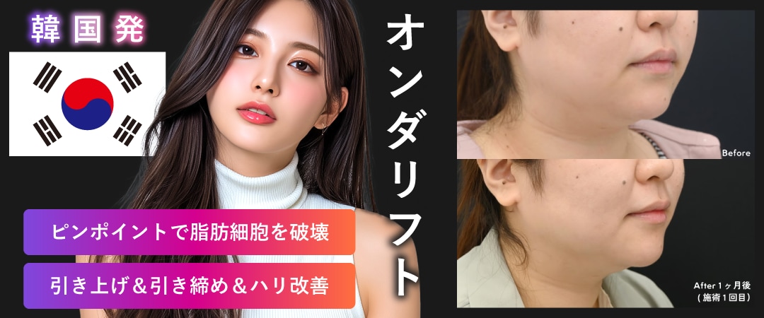 皮下脂肪撃退 ❶：オンダリフト