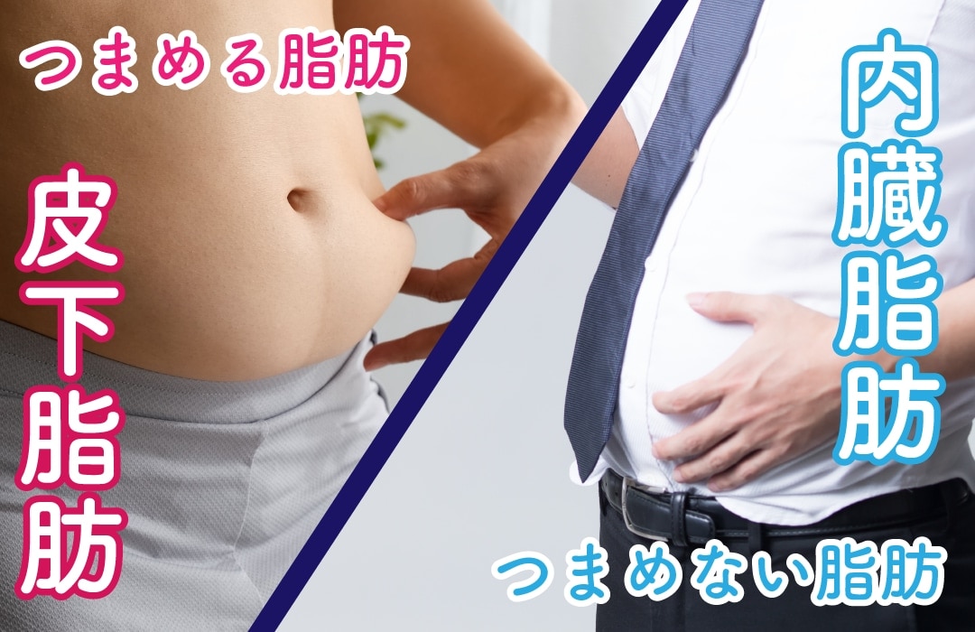 皮下脂肪型or内蔵脂肪型