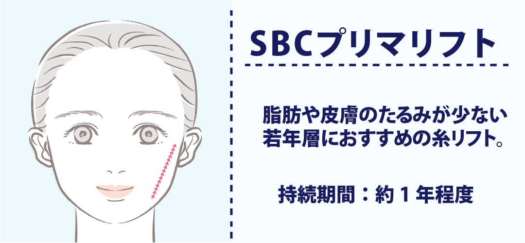 SBCプリマリフト