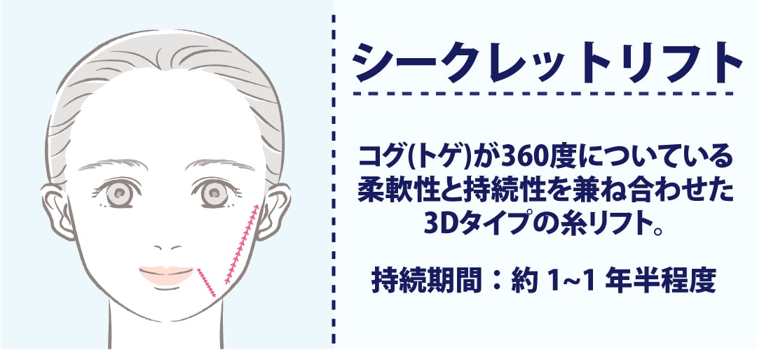 シークレットリフト