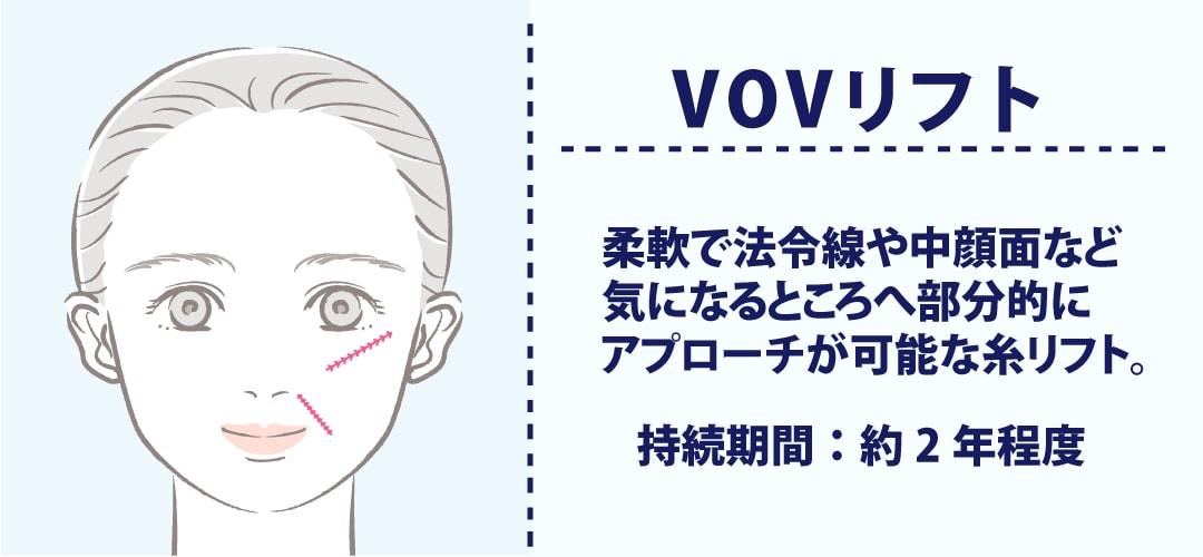 VOVリフト